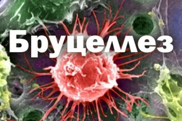 ПАМЯТКА ДЛЯ НАСЕЛЕНИЯ  «МЕРЫ ПО ПРОФИЛАКТИКЕ БРУЦЕЛЛЁЗА»